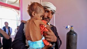 Yemen’s infants face starvation as war rages on