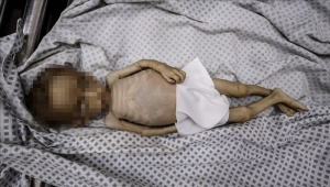 صحة غزة: ارتفاع وفيات التجويع الإسرائيلي إلى 193 بينهم 96 طفلا