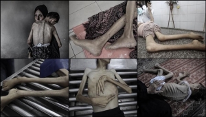 التجويع الإسرائيلي يقتل 13 فلسطينيا بينهم 3 أطفال في 24 ساعة