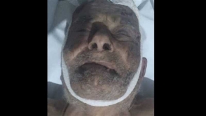 وفاة شخص مجهول الهوية في حادث سير بإب