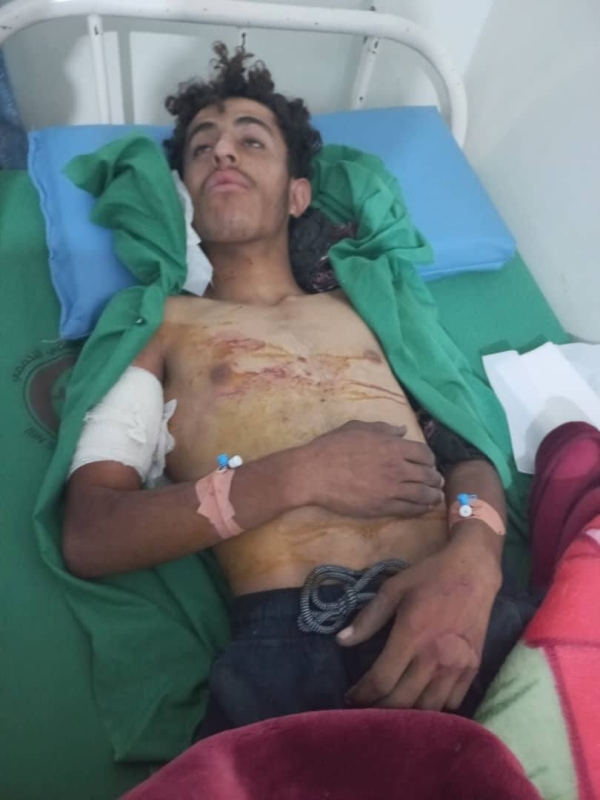 إصابة 4 أشخاص برصاص الحوثيين في الضالع