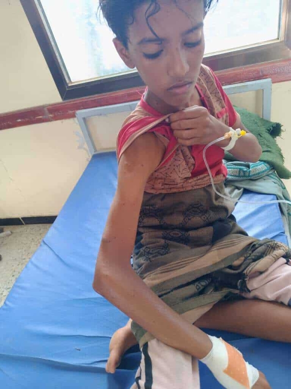 إصابة طفل برصاص قناص حوثي شمال لحج