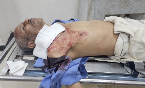 تعز.. إصابة مواطن برصاص قناص حوثي